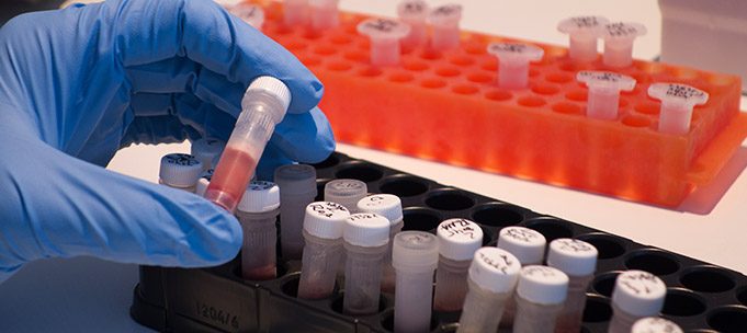 Preparación de muestras en gradilla