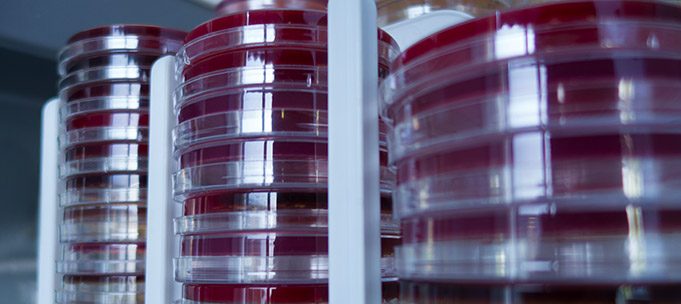 Placas de cultivo microbiológico en Norbio Analítica